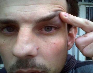 Un intendente armado amenazó de muerte y golpeó a un periodista