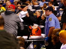 por distraida, una mujer recibio un pelotazo en un partido de beisbol por distraida, una mujer recibio un pelotazo en un partido de beisbol