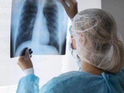alerta por fuerte aumento de casos de tuberculosis en argentina: subieron un 80% en 5 anos alerta por fuerte aumento de casos de tuberculosis en argentina: subieron un 80% en 5 anos