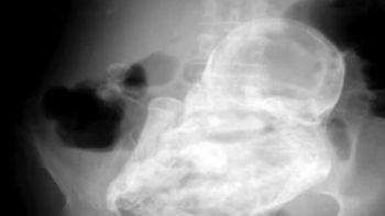 a los 82 anos, descubrio que habia estado embarazada por 40 anos a los 82 anos, descubrio que habia estado embarazada por 40 anos