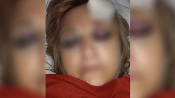 Atacó a batazos a los padres de una chica a la que violó cuando era una niña Atacó a batazos a los padres de una chica a la que violó cuando era una niña