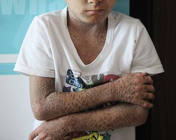 Conmueve a China el extraño caso del niño pez