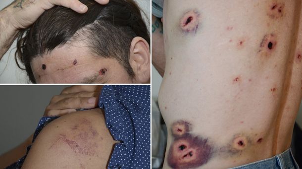 Denuncian que policías borrachos dispararon a los invitados en una fiesta de 15