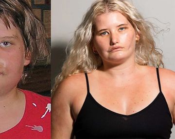 De sufrir bullying a ser modelo: el caso de la joven que no puede sonreír