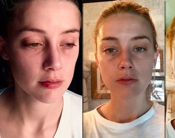 Revelan nuevas fotos de la mujer de Johnny Depp con golpes en la cara