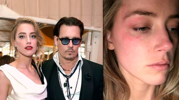 Johnny Depp, denunciado por haber golpeado a su esposa: la imagen que lo compromete