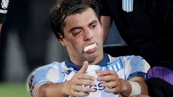 santiago sosa sufrio una fractura tras el golpe con marcos rojo en flamengo vs. racing santiago sosa sufrio una fractura tras el golpe con marcos rojo en flamengo vs. racing