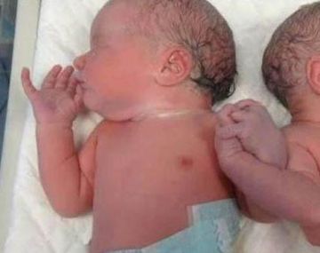 Dos gemelos españoles se dieron la mano al nacer