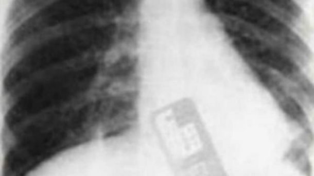 Este fue un año lleno de episodios confusos en las guardias de EEUU