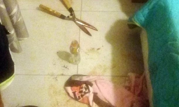 Córdoba: una joven le cortó el miembro a su amante con una tijera de podar mientras  dormía