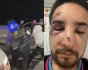 Descontrol en Río Gallegos: una discusión de tránsito derivó en una feroz pelea