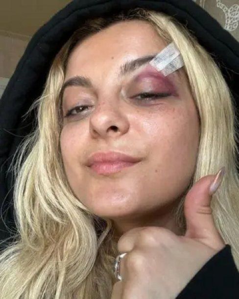 Agredieron a la cantante Bebe Rexha en medio de un recital