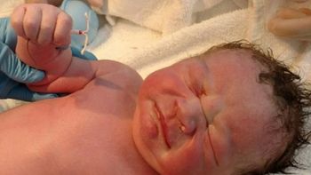 El bebe nació con el DIU en la mano El bebe nació con el DIU en la mano
