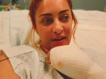 La impactante imagen de María Julia Oliván tras sufrir graves quemaduras