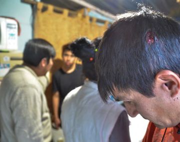 Pelea entre vecinos de Neuquén - Crédito: Omar Novoa/lmneuquen