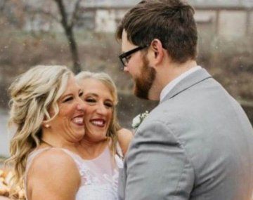 Una de las famosas siamesas Hensel encontró el amor y se casó