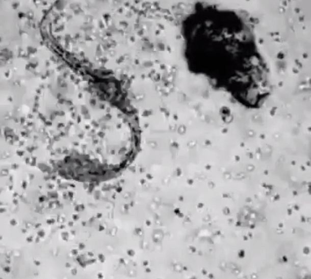 Así atacan los glóbulos blancos a un virus cuando entra a tu organismo