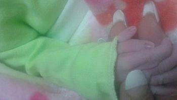 Una beba nació en Tucumán con seis dedos en su mano derecha. Una beba nació en Tucumán con seis dedos en su mano derecha.