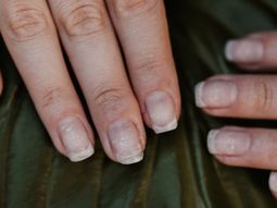 La vitamina C del limón ayuda mejorar tus uñas y tenerlas sanas y fuertes. La vitamina C del limón ayuda mejorar tus uñas y tenerlas sanas y fuertes.