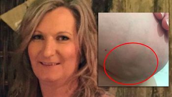 facebook dio de baja la foto de la mujer que mostro su cancer facebook dio de baja la foto de la mujer que mostro su cancer