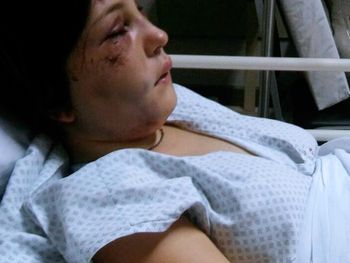 Tiene golpes en la cara y en la espalda. Todavia no puede escuchar de un oído