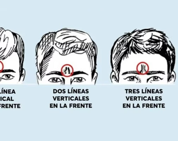 Test viral: las líneas de tu frente pueden revelar rasgos de tu personalidad