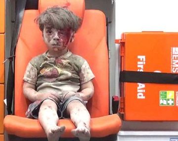 Así está Omran Daqnesh