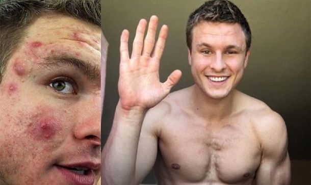 El antes y después de Brian Turner