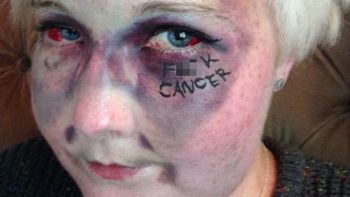 se saca una impactante selfie para concientizar sobre la enfermedad: mira la foto se saca una impactante selfie para concientizar sobre la enfermedad: mira la foto