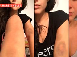 mas fotos de barbie velez con moretones mas fotos de barbie velez con moretones