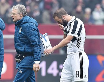 Un respiro para Sampaoli: la lesión de Higuaín fue un esguince de tobillo