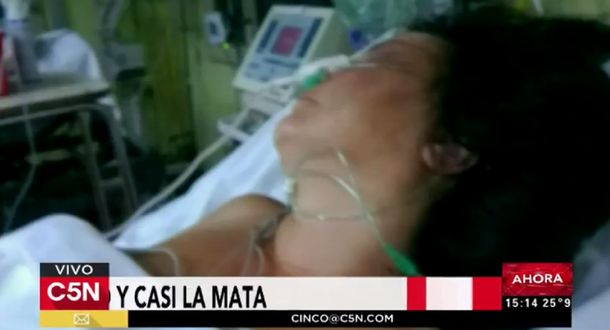 Tras agonizar 10 días, murió la mujer atacada a golpes por el marido
