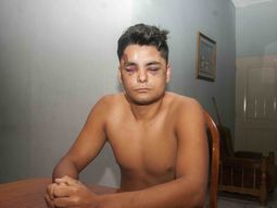 Claudio Torres Brizuela fue salvajemente golpeado por la policía