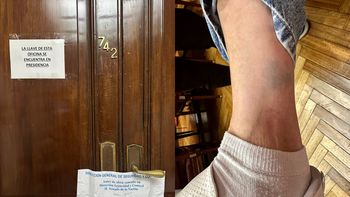 escandalo en el senado: legisladora denuncio penalmente a personal de seguridad por lesiones y amenazas escandalo en el senado: legisladora denuncio penalmente a personal de seguridad por lesiones y amenazas