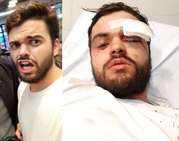 Liberaron a los cinco detenidos por golpear a Jonathan Castellari