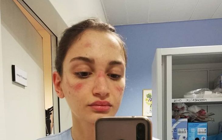 El mensaje y las fotos de dos enfermeras agotadas por el coronavirus