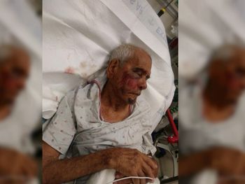 Una mujer golpeó a un mexicano de 91 años con un ladrillo: Volvete a tu país