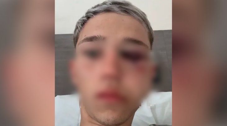 El audio de uno de los rugbiers que atacó a un chico de 16 años en Mendoza: Le agarré la cabeza y le di con la rodilla