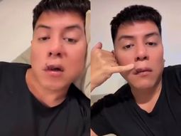 Mariano de la Canal fue mordido por un perro en la cara: así mostró cómo le quedó