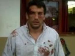 policias golpean ferozmente a un rugbier por error policias golpean ferozmente a un rugbier por error