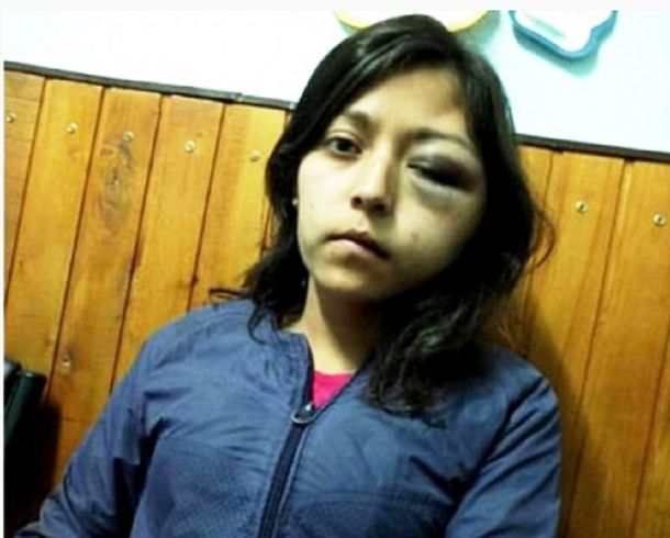 Mariana Arabena fue atacada por Alejandro Patricio Santarrosa