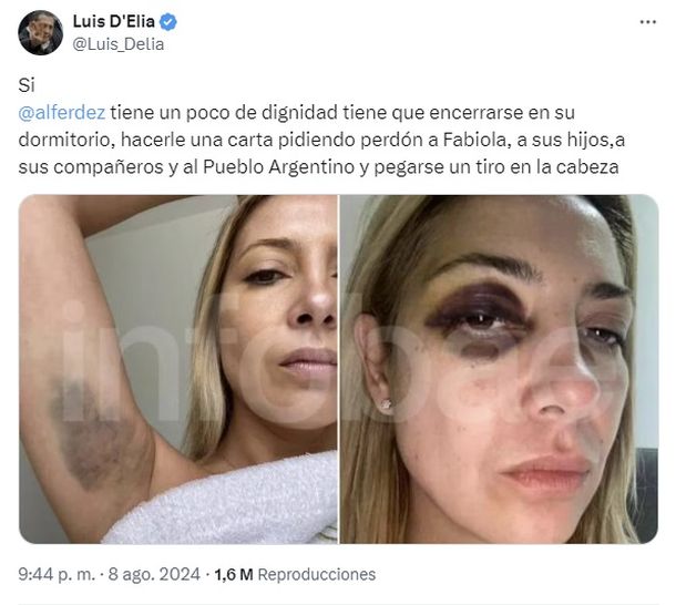 El posteo de Luis D'Elia luego de que salieran a la luz las fotos de Fabiola Yañez El posteo de Luis D'Elia luego de que salieran a la luz las fotos de Fabiola Yañez