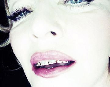 Madonna ahora marca tendencia con sus raras fundas dentales