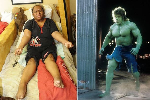 Una mujer se convierte en la Increíble Hulk femenina