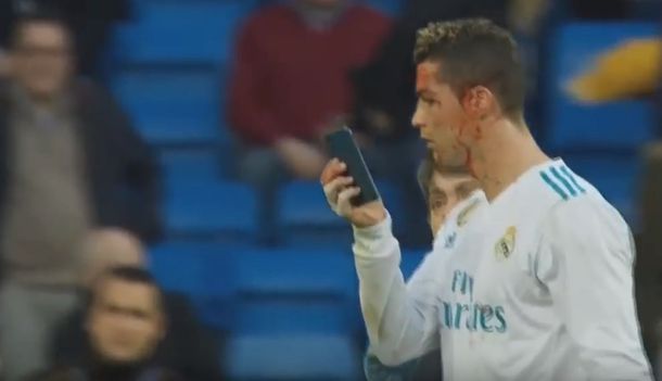 Cristiano Ronaldo se cortó la cara y pidió mirarse con un celular