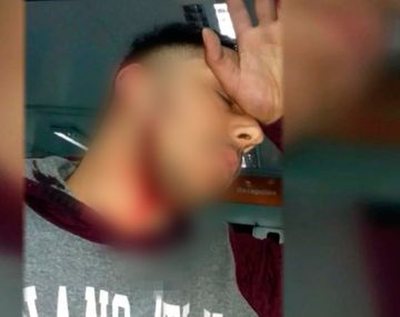 Atacaron a un colectivero en Villa Fiorito: le cortaron el cuello para robarle
