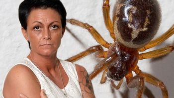 perdio un dedo tras ser mordida por una arana perdio un dedo tras ser mordida por una arana