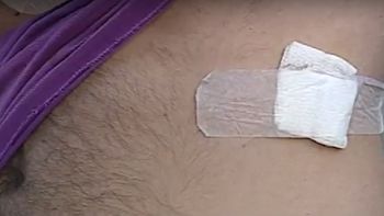 Un taxista denunció que un chofer de Uber lo apuñaló Un taxista denunció que un chofer de Uber lo apuñaló