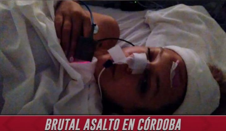 Córdoba: una joven está grave tras el brutal robo de su bicicleta