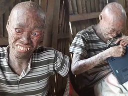 Reloj tiene 26 años y sufre esta condición desde los 12 Reloj tiene 26 años y sufre esta condición desde los 12